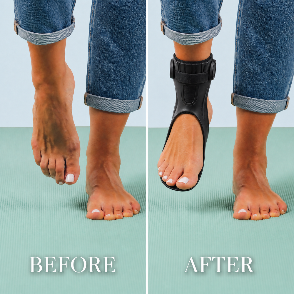 Before and after wearing Maivelo foot drop brace