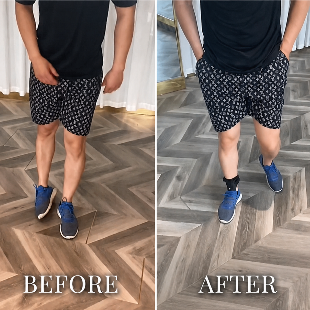 Before and after wearing Maivelo foot drop brace